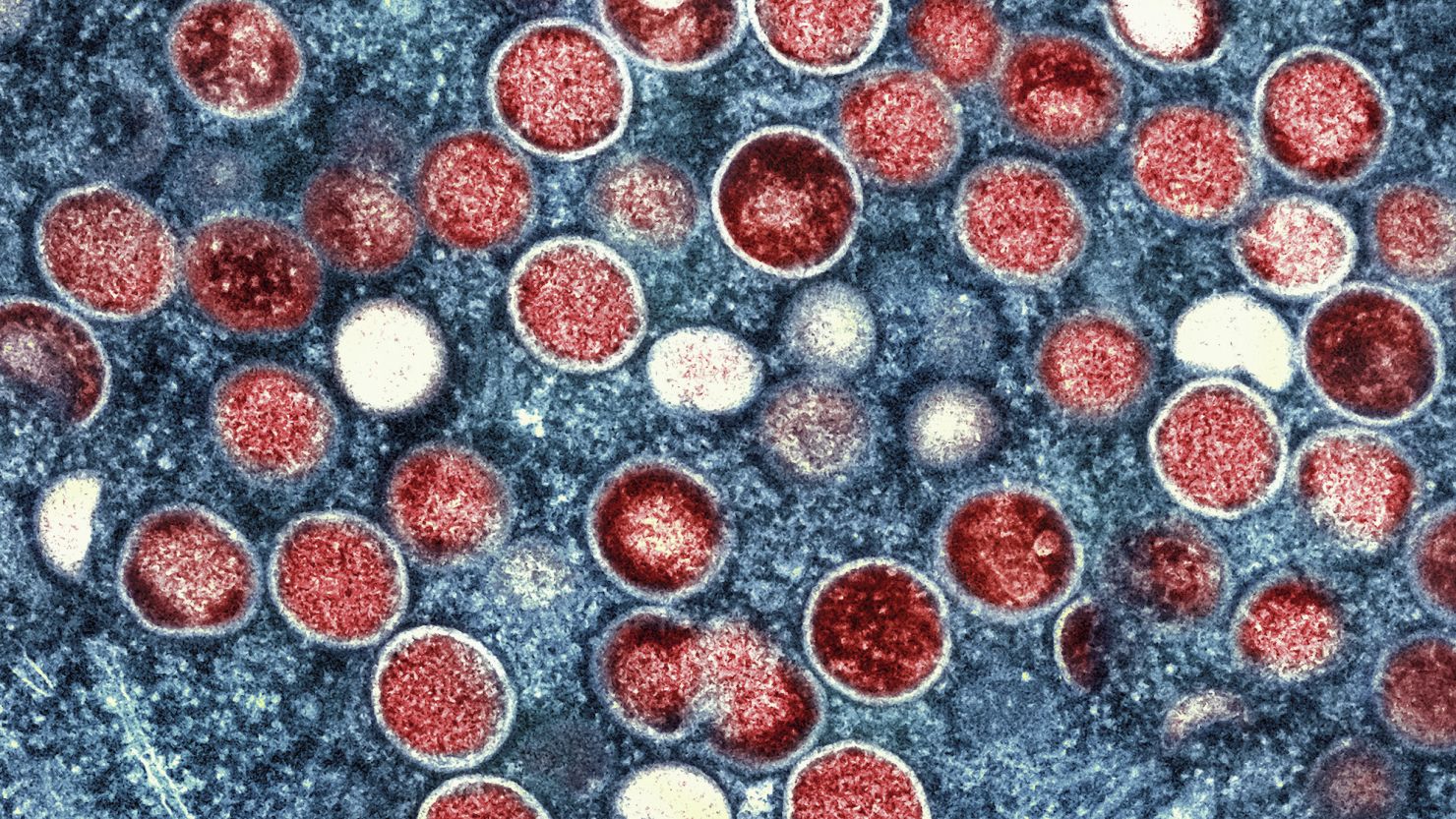 An image issued by the National Institute of Allergy and Infectious Diseases shows mpox particles found within an infected cell.