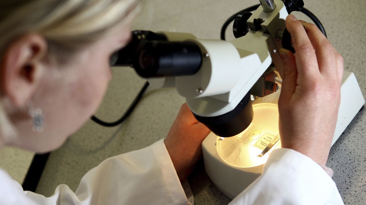 EMBARGOED TO 0001 THURSDAY AUGUST 31 File photo dated 19/05/08 of a woman looking through a microscope, as more money should be spent on research aimed at diagnosing and treating childhood cancer, a charity has said. 73519216 (Press Association via AP Images)