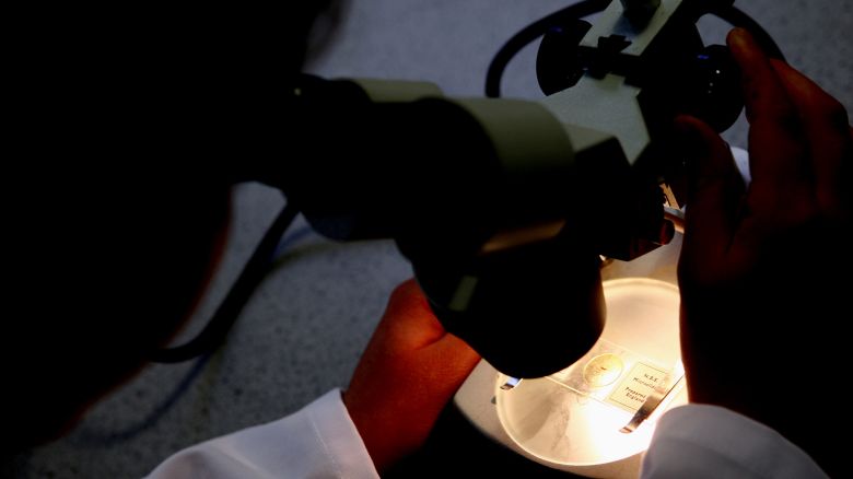 In this file photo, a student examines matter under a microscope. New research has found that a male contraceptive gel takes effect sooner than similar methods for male birth control.