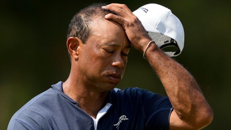 Tiger Woods wipes his face on the 10th hole during weather warnings in second round of the U.S. Open golf tournament Friday, June 14, 2024, in Pinehurst, N.C.