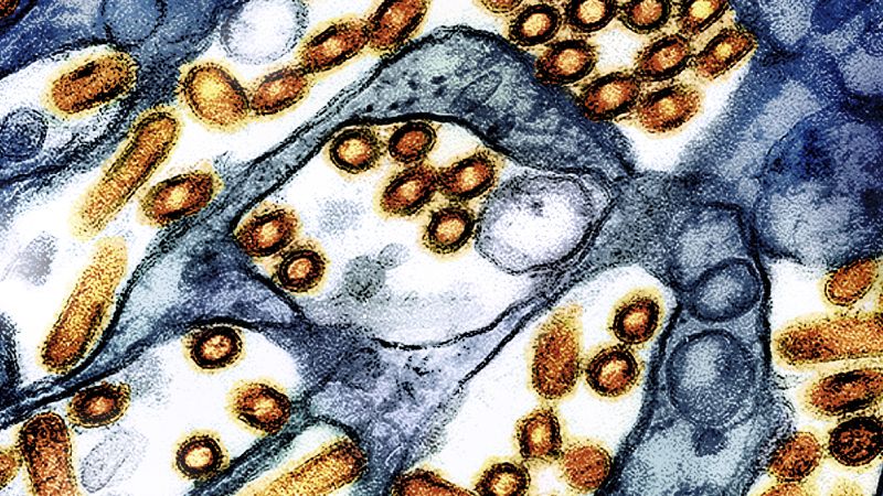 The US hasn’t seen a human bird flu case in 3 months. Experts are wondering why | CNN