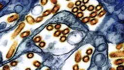 This colorized electron microscope image provided by the National Institute of Allergy and Infectious Diseases in 2024 shows avian influenza A virus (bird flu) particles, red/yellow, grown in cultured cells. (CDC, NIAID via AP)