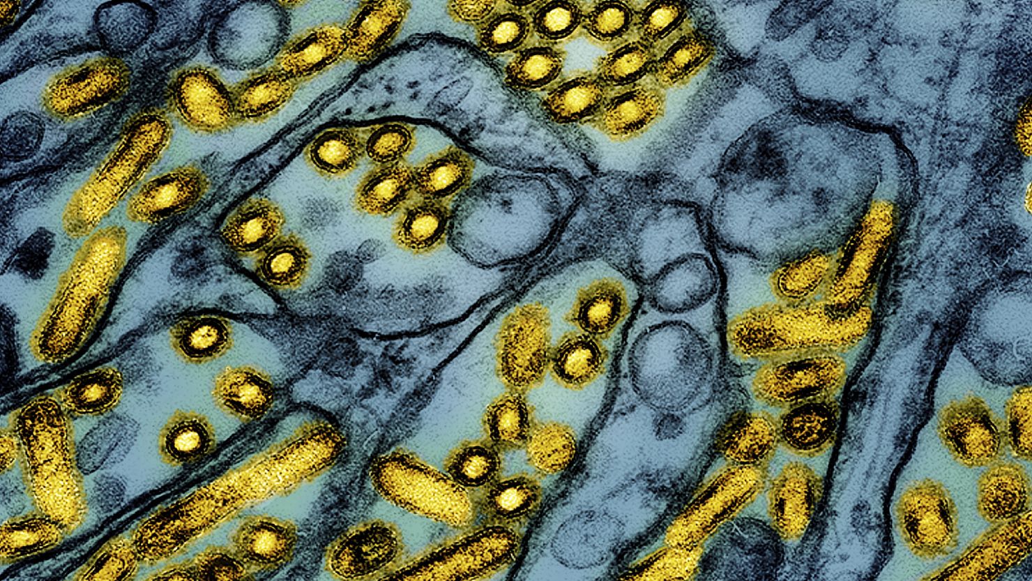 America’s first severe case of bird flu confirmed in Louisiana CNN