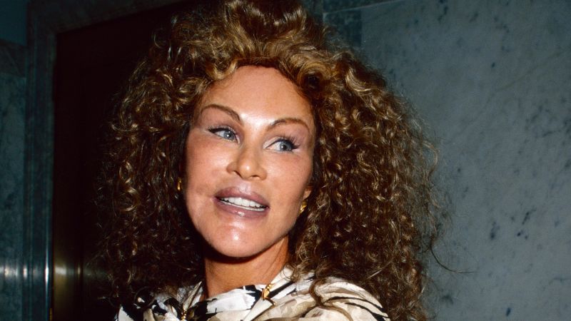 Jocelyn Wildenstein, ‘Catwoman’ socialite known for her extreme cosmetic surgery, dies