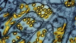 FILE -This colorized electron microscope image released by the National Institute of Allergy and Infectious Diseases on March 26, 2024, shows avian influenza A H5N1 virus particles (yellow), grown in Madin-Darby Canine Kidney (MDCK) epithelial cells (blue). (CDC/NIAID via AP, File)