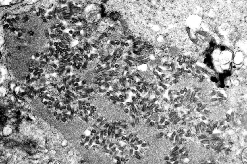 America is monitoring 14 possible rabies outbreaks in 20 states. Right here’s what to grasp | The Gentleman Report