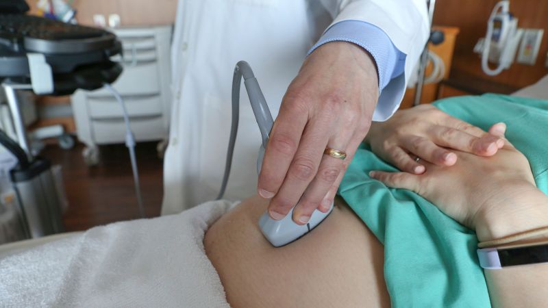 Alarming Rise in US Maternal Death Rate: What You Need to Know