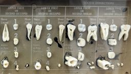 Dissected human teeth are displayed in the office of dentist Dr. James Bekker, April 30, 2025, in Salt Lake City, Utah. (AP Photo/Hannah Schoenbaum)