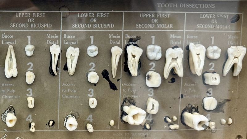Utah's Fluoride Ban: A Public Health Gamble?
