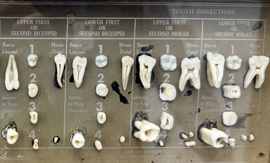 Fluoride can help prevent tooth decay by strengthening the protective outer layer of enamel.