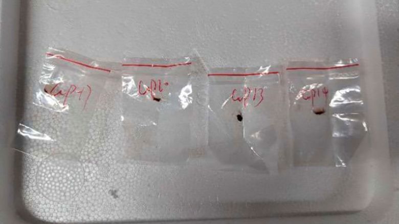This image provided by United States District Court For The Eastern District Of Michigan shows toxic plant pathogens that a Chinese scientist entered the US last year stashed in his backpack, federal authorities said Tuesday, June 3, 2025, as they filed charges against him and a girlfriend who worked in a lab at the University of Michigan.