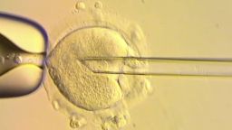 This image from the Newcastle Fertility Centre shows a nuclear genome from an egg carrying a mitochondrial DNA mutation being inserted into an egg donated by an unaffected woman.