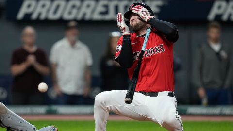 Cleveland Guardians star David Fry was hit in the face with a fastball.