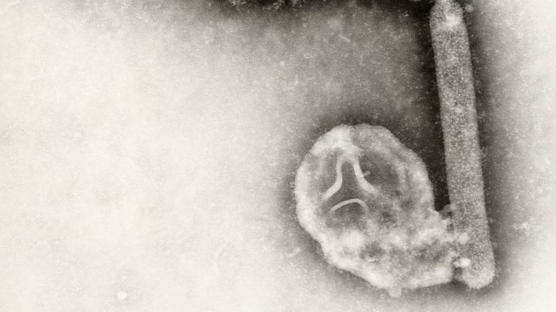 FILE - This undated electron microscopic image provided by the Centers for Disease Control and Prevention shows two Influenza A (H5N1) virions, a type of bird flu virus. (Cynthia Goldsmith, Jackie Katz/CDC via AP, File)