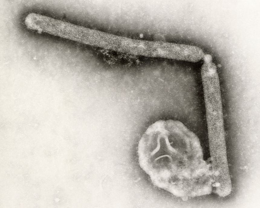 As of mid-September, 71 human cases of bird flu have been reported in the US as part of the ongoing outbreak, with one death.