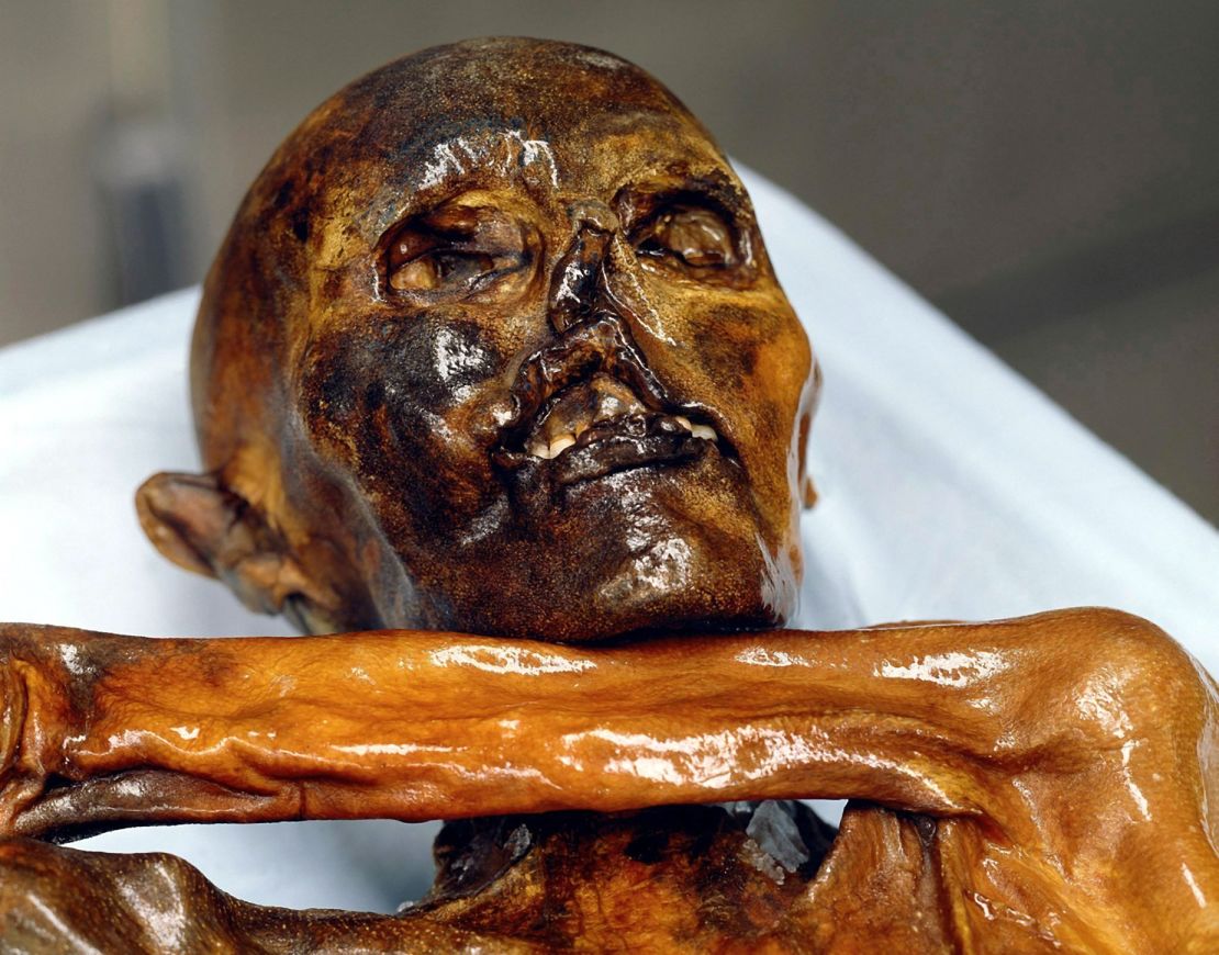 A close-up of the head of the 5,300-year-old frozen corpse of Ötzi in the Archaeological Museum in Bolzano.
