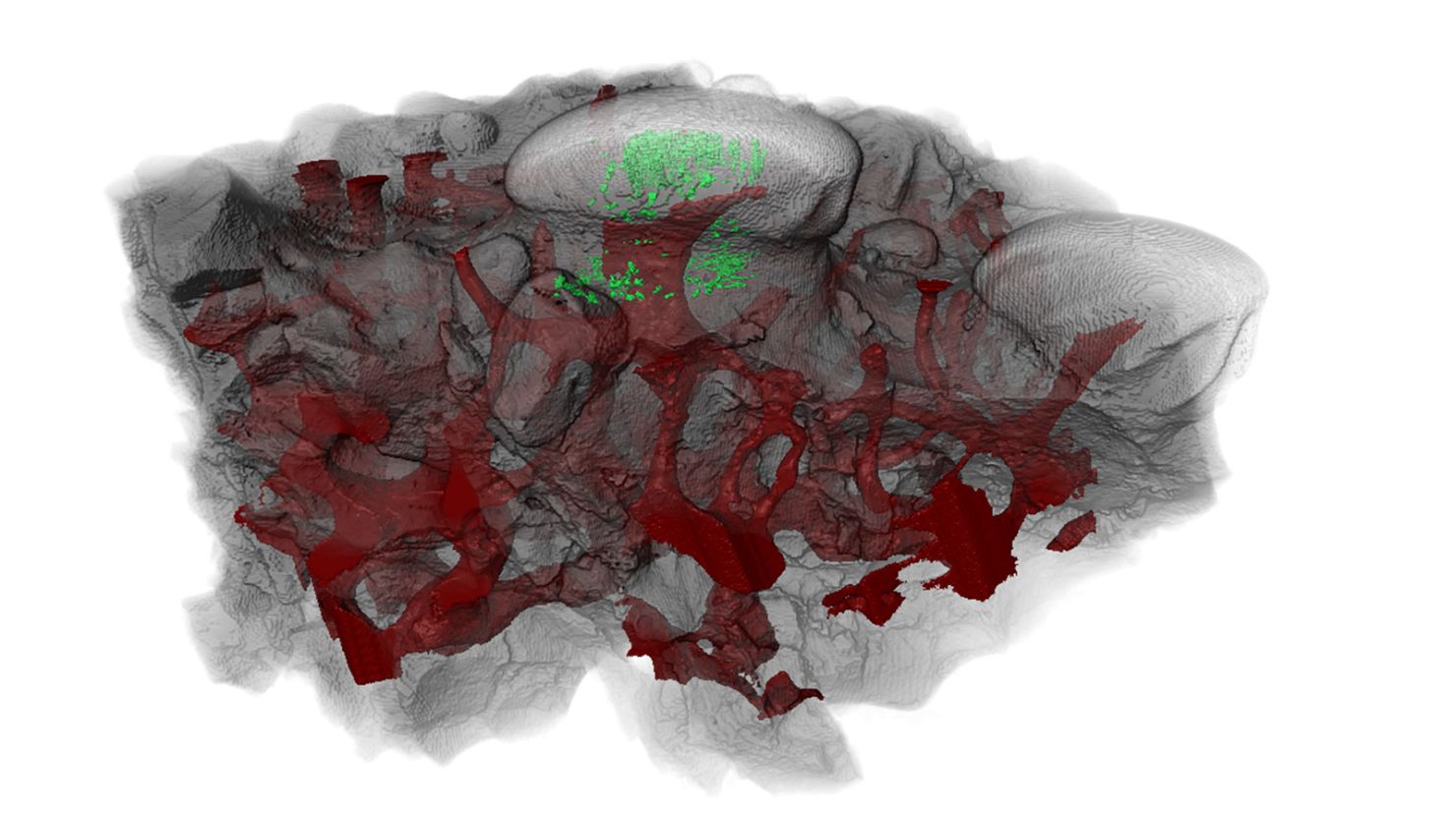 A CT scan of the tooth-like odontode structure from Astrapsis, an ancient jawless vertebrate fish shows that its tubules (shown in green) are filled with dentine, which also serves as the sensitive inner layer of modern teeth.
