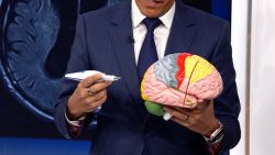 billy-joel-brain-disorder-treatment-sanjay-gupta-image1.jpg
