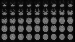 Functional magnetic resonance imaging (fMRI), a non-invasive technique that measures brain activity, showing multiple horizontal views of the brain, arranged from bottom to top.