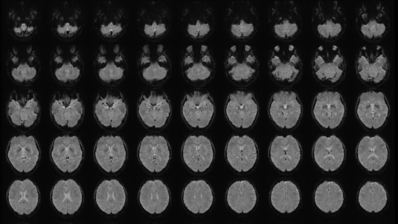 Functional magnetic resonance imaging (fMRI), a non-invasive technique that measures brain activity, showing multiple horizontal views of the brain, arranged from bottom to top.