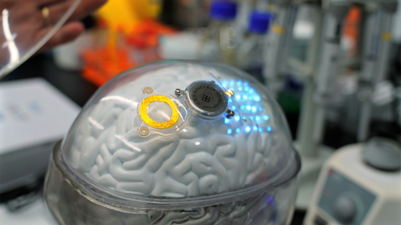 The Beinao-1, a wireless so-called brain computer interface (BCI), created by China's Chinese Institute for Brain Research