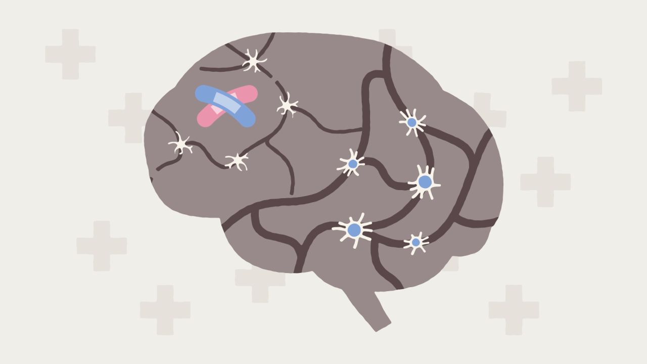 BrainOnRewiring.00_01_06_25.Still003.jpg
