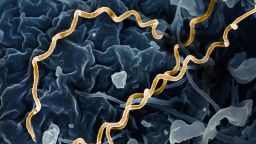 Colorized electron micrograph of Treponema pallidum, the bacteria that cause syphilis. Several spiral-shaped bacteria have been highlighted in gold.