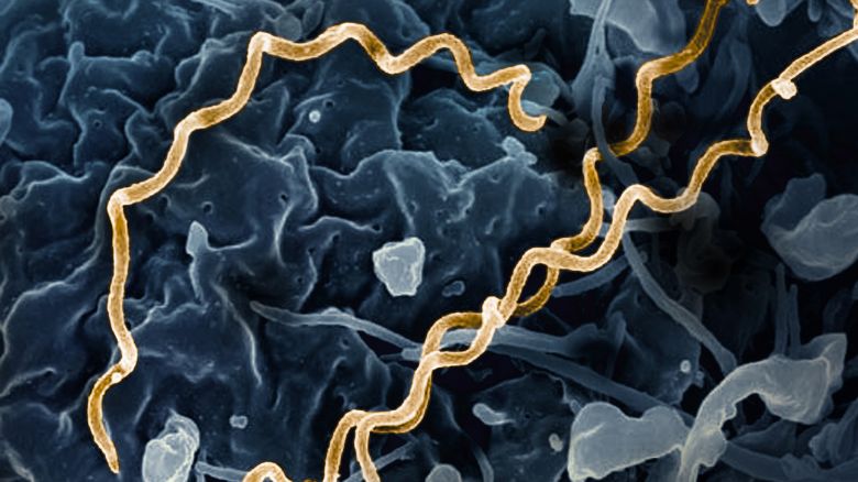 Colorized electron micrograph of Treponema pallidum, the bacteria that cause syphilis. Several spiral-shaped bacteria have been highlighted in gold.