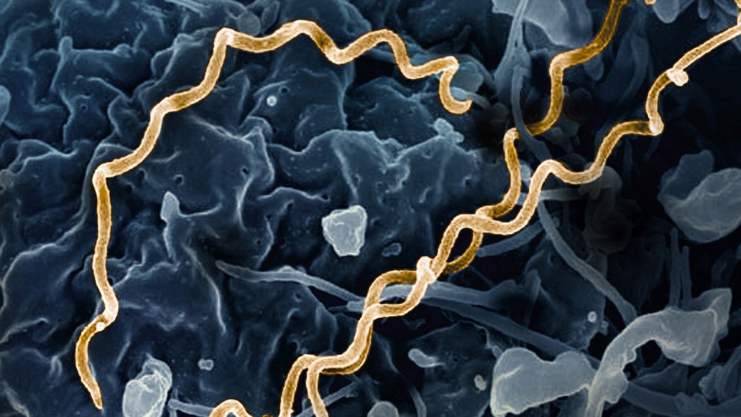 Syphilis is caused by the bacteria Treponema pallidum. Cases have been increasing in the United States.