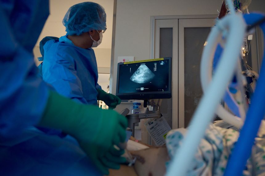 Vasishta Tatapudi, MD, transplant nephrologist for the NYU Langone Transplant Institute, performs a biopsy of a genetically engineered pig kidney on Day 61 of the latest xenotransplant study at NYU Langone Health.