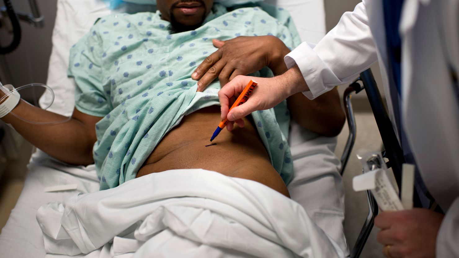A doctor at Johns Hopkins Hospital marks which kidney to remove from a living Black donor in this photo from 2012.