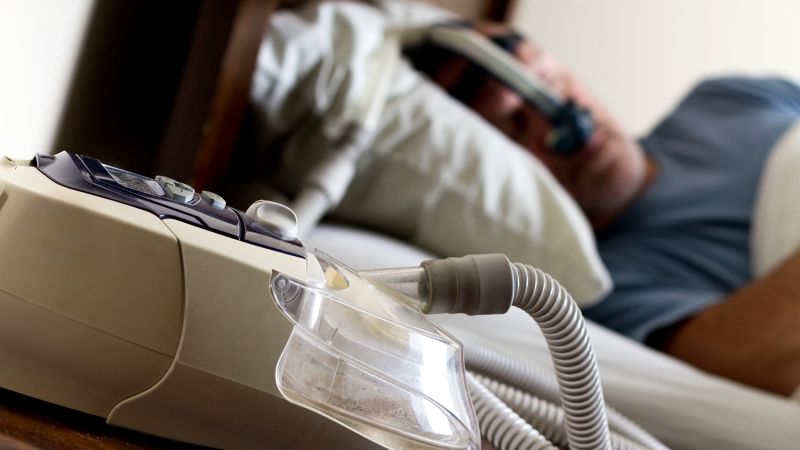 Study finds CPAP alternative therapy is effective against overweight, not obesity