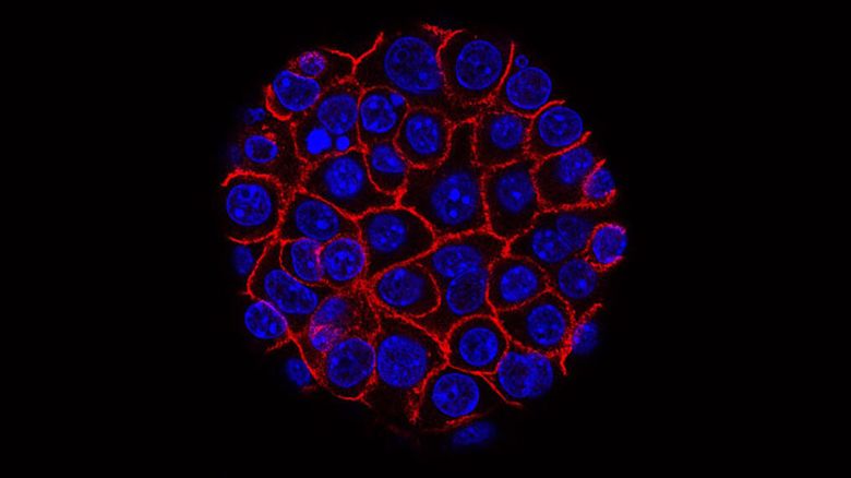 This image from the National Cancer Institute shows pancreatic cancer cells (blue) growing as a sphere encased in membranes (red). 