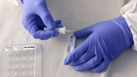 A health worker processes a rapid antigen Covid-19 test on February 23, 2021 in Naumburg, Germany. 