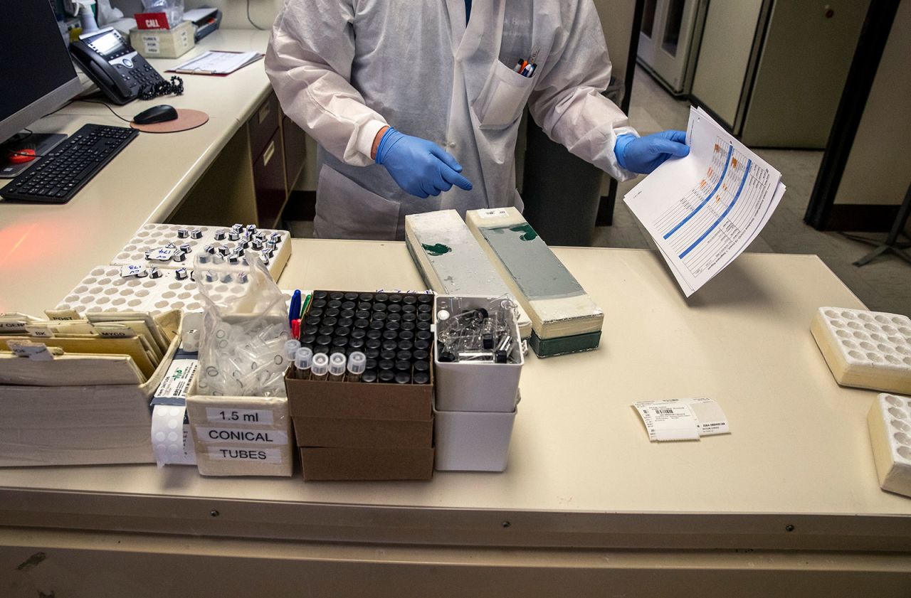 A medical technologist catalogs samples at the UCLA clinical microbiology lab in Brentwood, California, on March 28.