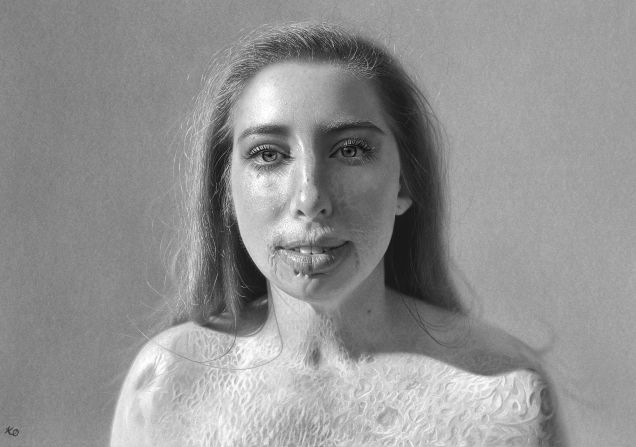 Pictured here, Catrin Pugh is a burns survivor, inspirational speaker and advocate reshaping perceptions around burn recovery. The exhibition is at London’s Hope 93 gallery until July 3.