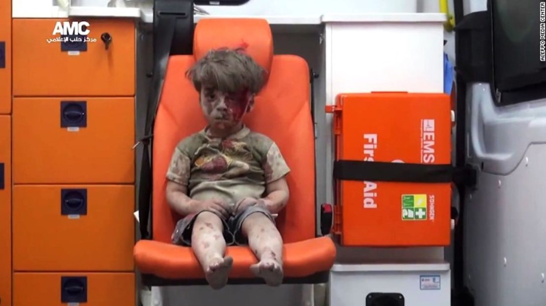 Esta imagen de Omran Daqneesh fue ampliamente divulgada después del ataque de agosto del año pasado.