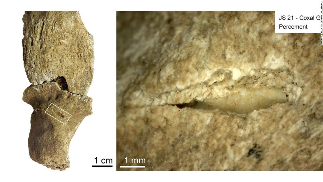 La marca hecha por un arma de proyectil, como una lanza de piedra o una punta de flecha, se ve en la superficie de un hueso de la cadera.