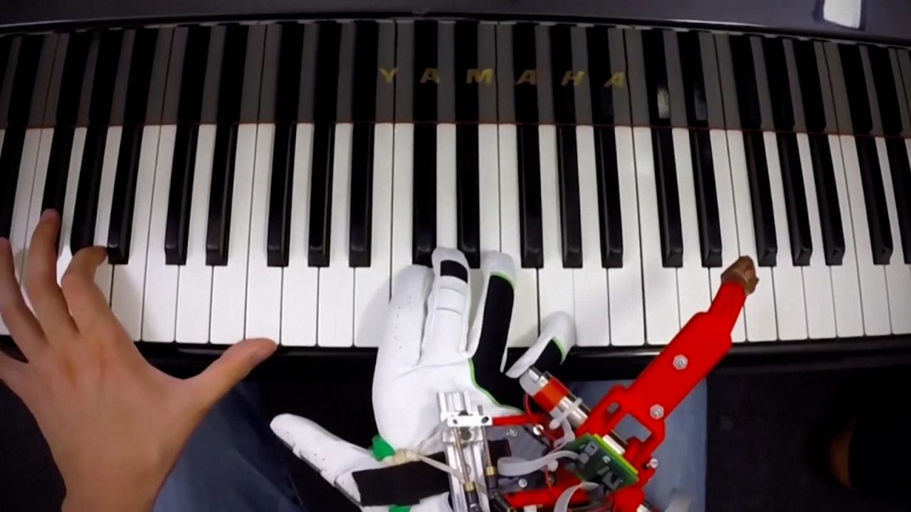 CNNE 1055371 - este pulgar robotico sirve para tocar el piano