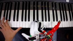 CNNE 1055371 - este pulgar robotico sirve para tocar el piano