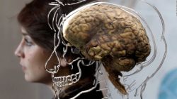 CNNE 1110167 - conoce algunos de los mitos sobre el cerebro humano