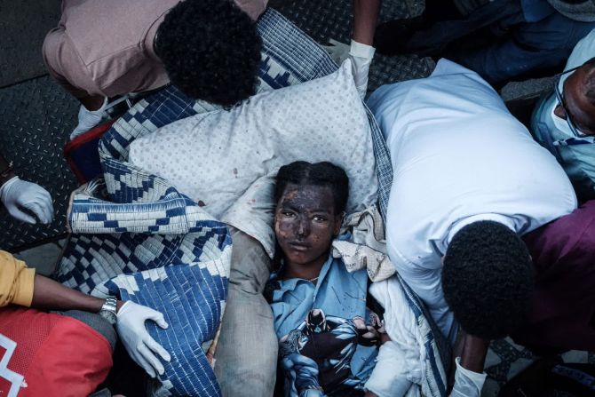 22 de junio — un habitante de Togoga, Etiopía, llega herido a un hospital de Mekelle, capital de la región de Tigray, tras un ataque aéreo del gobierno contra un mercado de Togoga. El ataque aéreo, que causó la muerte de decenas de personas, fue condenado por la comunidad internacional al intensificarse los enfrentamientos entre el partido gobernante de Tigray y las fuerzas alineadas con el ejército etíope.