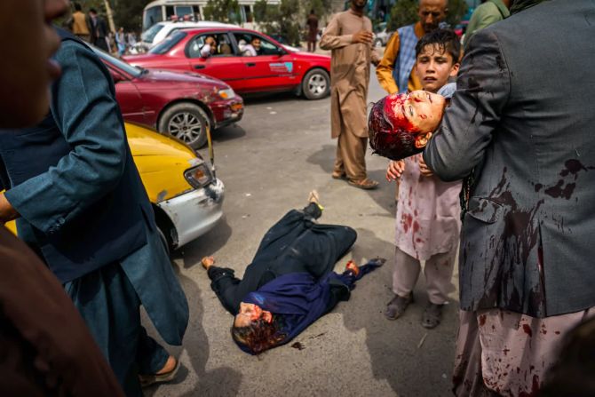 17 de agosto — un hombre lleva a un niño ensangrentado mientras una mujer herida yace en la calle después de que los combatientes talibanes dispararan armas de fuego y arremetieran con látigos, palos y objetos punzantes para controlar a una multitud a las afueras del aeropuerto en Kabul, Afganistán.