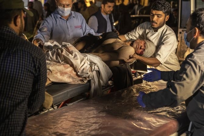 26 de agosto — una persona herida llega a un hospital tras la explosión de una bomba que llevaba un atacante suicida en el aeropuerto internacional de Kabul, Afganistán. El atentado, en el que murieron decenas de civiles afganos y 13 del ejército estadounidense, se produjo cuando Estados Unidos y otros países occidentales se apresuraban a completar una evacuación masiva tras la toma del país por los talibanes. El grupo terrorista ISIS-K se atribuyó la autoría del atentado.