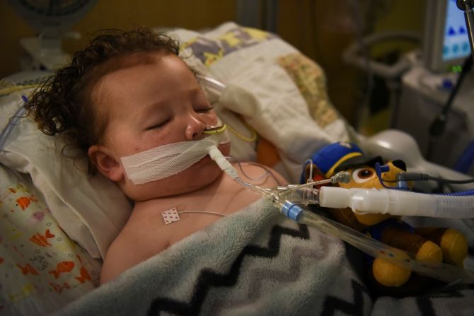 5 de octubre — Adrian James, un niño de 2 años que dio positivo en la prueba de covid-19, respira con la ayuda de un ventilador en el Cardinal Glennon Children's Hospital en St. Louis. Finalmente fue retirado del respirador artificial y pudo regresar a casa, informó Reuters. Su madre, Tiffany Jackson, esperaba que su historia ayudara a otros. “Solo quiero que la gente se dé cuenta de que es algo serio”, dijo.