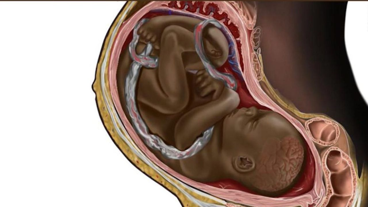 CNNE 1115989 - crean ilustracion de feto negro para mayor diversidad