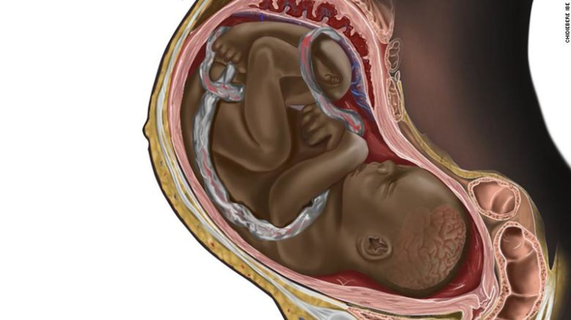 Una imagen de un feto negro en un vientre materno realizada por el ilustrador Chidiebere Ibe captó la atención de Internet recientemente, y muchas personas señalaron que nunca habían visto pieles oscuras en este tipo de imágenes.