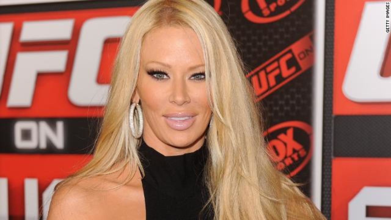 Jenna Jameson no padece síndrome de Guillain-Barré, sino una 