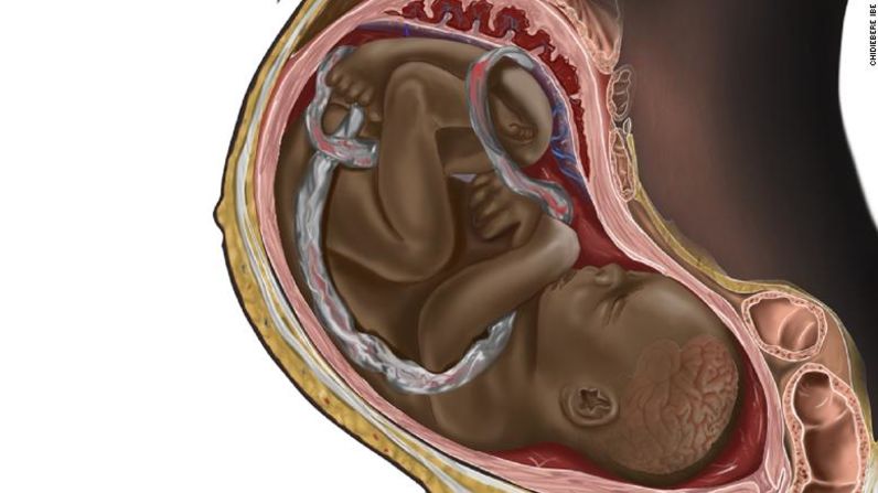 Esta imagen del ilustrador nigeriano Chidiebere Ibe de un feto negro en el vientre materno se hizo viral el pasado diciembre. Ibe, que aún es estudiante de medicina, verá ahora publicadas algunas de sus ilustraciones en un manual clínico. Crédito: Chidiebere Ibe