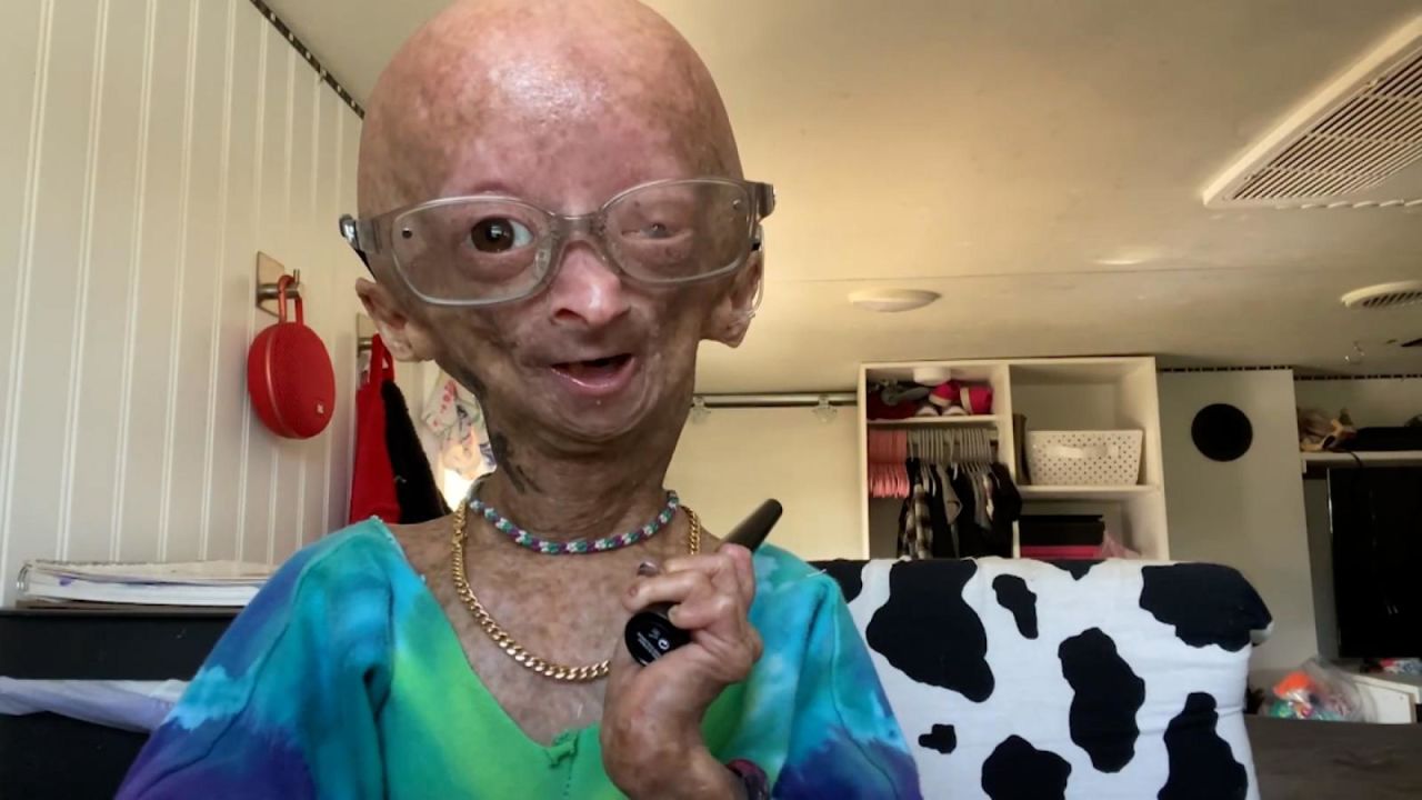 CNNE 1137649 - murio la influencer de youtube adalia rose williams